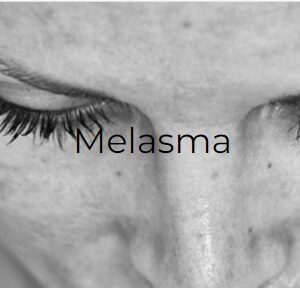 Skin Assessment/ Consultation